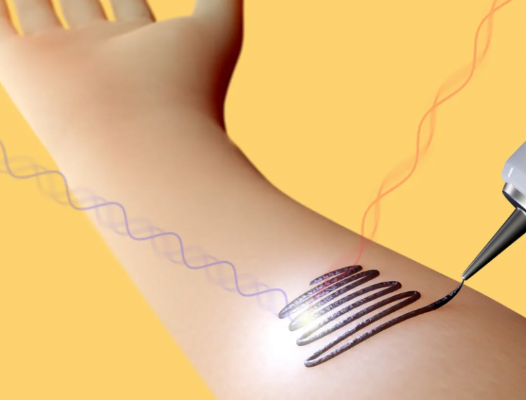 Επιστήμονες δημιούργησαν νανοτατουάζ απο γραφένιο με βιοαισθητήρα ραδιοσυχνοτήτων (RF)