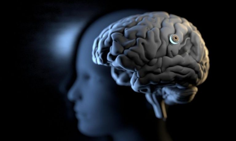 Έλον Μασκ: Μέχρι το τέλος του έτους θα εμφυτεύσει το πρώτο τσιπ σε ανθρώπινο εγκέφαλο