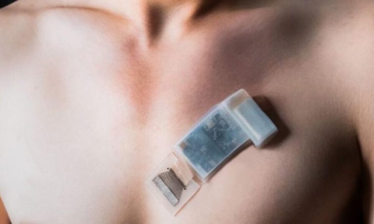 Επιστήμονες ανέπτυξαν φορετό αισθητήρα για την υγεία των οργάνων