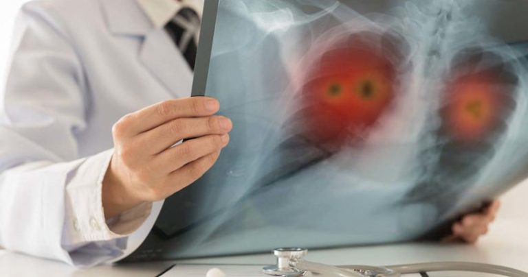 Κρήτη: «Θερίζει» ο καρκίνος-Έντονη ανησυχία στην ιατρική κοινότητα