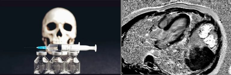 Η αλήθεια βγήκε επιτέλους στην επιφάνεια. Το “100% ασφαλές και αποτελεσματικό” αφήγημα, είναι επίσημα νεκρό