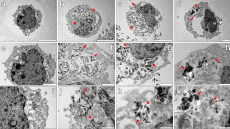 Γιατί πραγματικά βάζουν αλουμίνιο στα εμβόλια; Αυτή μπορεί να είναι η απάντηση