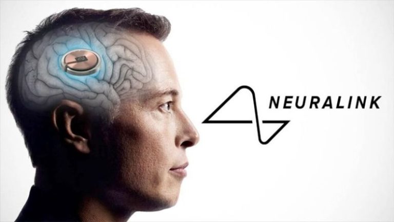 Neuralink: Προβλήματα εμφάνισε το πρώτο εμφύτευμα σε ανθρώπινο εγκέφαλο.