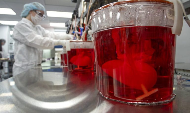 ΗΠΑ: Πέθανε ο πρώτος ασθενής που έλαβε γενετικά τροποποιημένο νεφρό από χοίρο