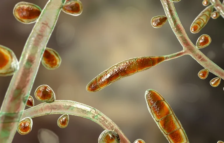 Νέο σεξουαλικώς μεταδιδόμενο νόσημα εντοπίστηκε στις ΗΠΑ – Ο ασθενής είχε έρθει και στην Ελλάδα