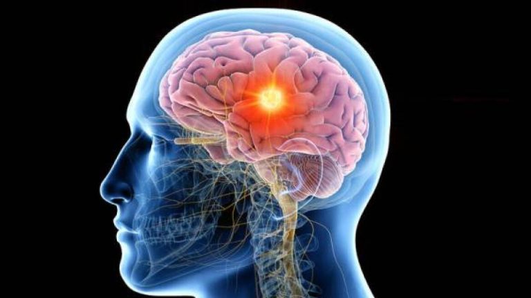 Μόλις αναπτύχθηκε ο πρώτος «μικροεγκέφαλος» από κύτταρα πολλών ανθρώπων