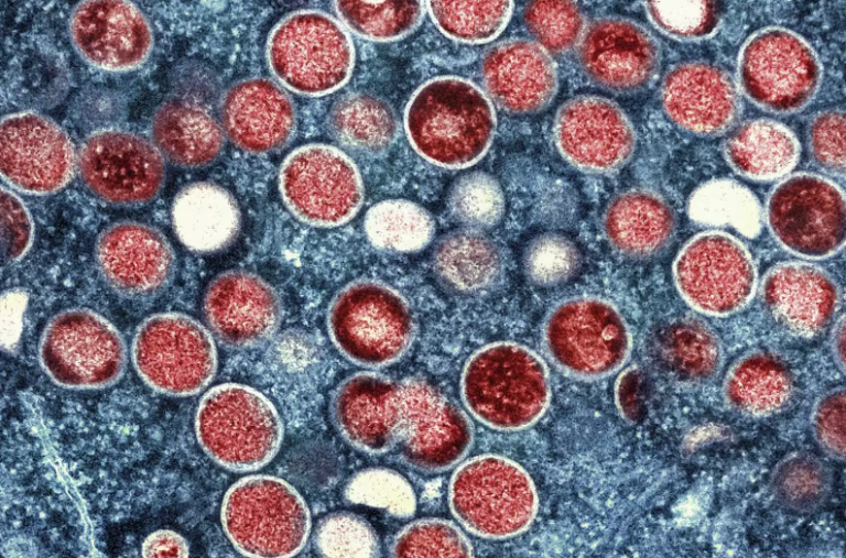 Mpox: Συναγερμός στον ΠΟΥ για την ευλογία των πιθήκων – Αυξάνονται τα κρούσματα