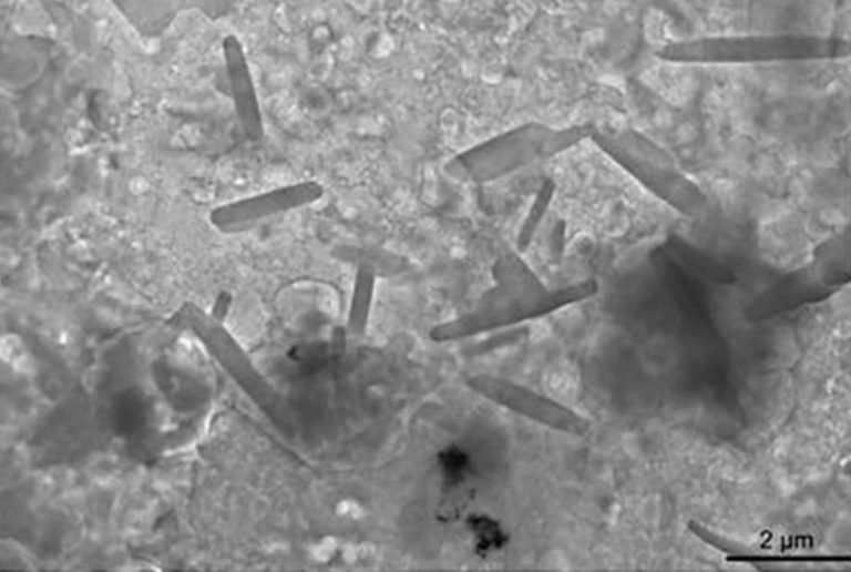 Tα μικροπλαστικά έχουν εισχωρήσει (και) στον ανθρώπινο εγκέφαλο