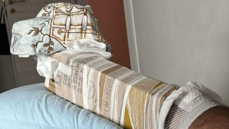 Ιταλία: Aκινητοποίησαν σπασμένο πόδι με χάρτινο κουτί, επειδή είχε τελειώσει ο γύψος στο νοσοκομείο!