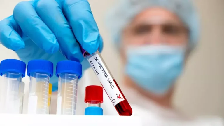 Συναγερμός για τον mpox στην Κίνα – Καταγράφηκαν 5 κρούσματα της νέας παραλλαγής clade 1b