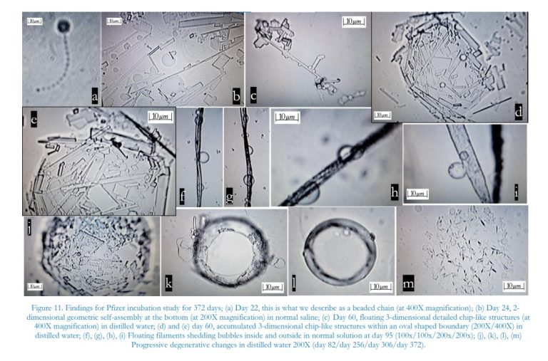 ΝΕΑ ΙΑΠΩΝΙΚΗ ΜΕΛΕΤΗ ΑΠΟΔΕΙΚΝΥΕΙ ΑΝΑΜΦΙΣΒΗΤΗΤΑ,  ΤΗΝ ΤΟΞΙΚΗ ΔΡΑΣΗ ΤΩΝ “ΕΜΒΟΛΙΩΝ”, ΟΛΩΝ ΤΩΝ ΕΙΔΩΝ. ΤΟΣΟ ΣΤΟ ΑΙΜΑ, ΟΣΟ ΚΑΙ ΣΤΟ ΠΛΑΣΜΑ ΚΑΙ ΣΤΟ ΣΠΕΡΜΑ