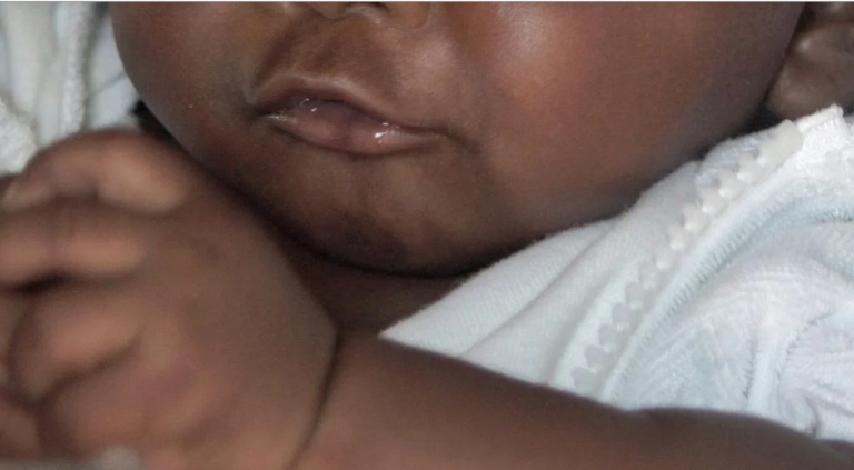 Κένυα: Μέσω ιδρύματος Γκέιτς το μικροτσίπ στα νεογέννητα!