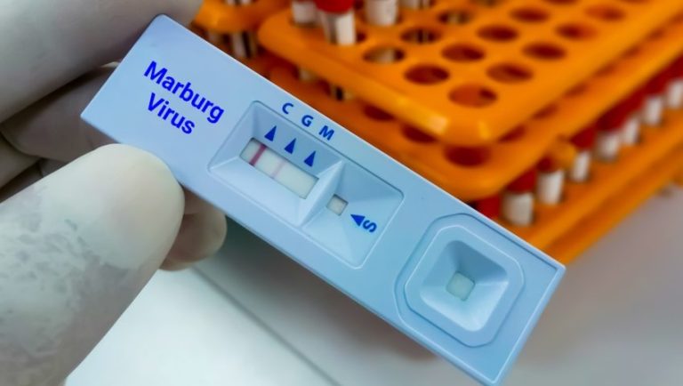 Ιός Μάρμπουργκ: Ξεκινούν κλινικές δοκιμές εμβολίου