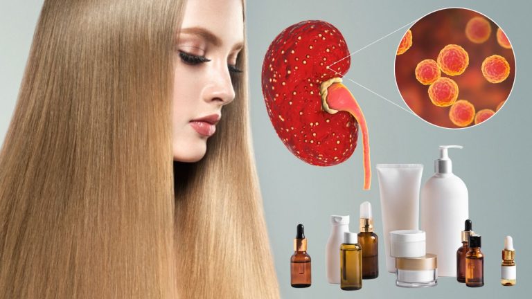 Συναγερμός για επικίνδυνα προϊόντα ισιώματος μαλλιών – Προκαλούν οξεία νεφρική ανεπάρκεια