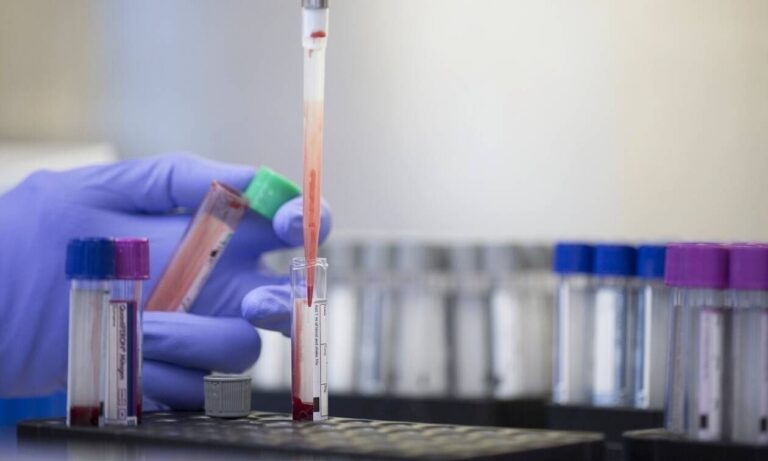 Οι επιστήμονες ανακάλυψαν μια νέα ομάδα αίματος μετά από 50 χρόνια έρευνας