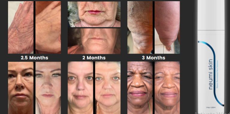 Neumi Skin: Η επανάσταση στην περιποίηση προσώπου και σώματος