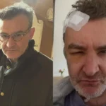 Ο Νίκος Ορφανός αποκάλυψε το πρόβλημα της υγείας του: «Ήρθα στη Γερμανία, γιατί είχα έναν όγκο στο κεφάλι»