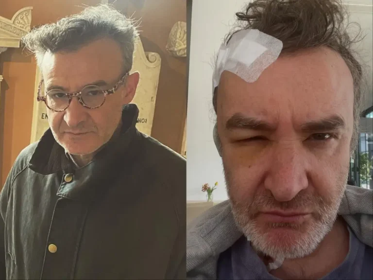 Ο Νίκος Ορφανός αποκάλυψε το πρόβλημα της υγείας του: «Ήρθα στη Γερμανία, γιατί είχα έναν όγκο στο κεφάλι»