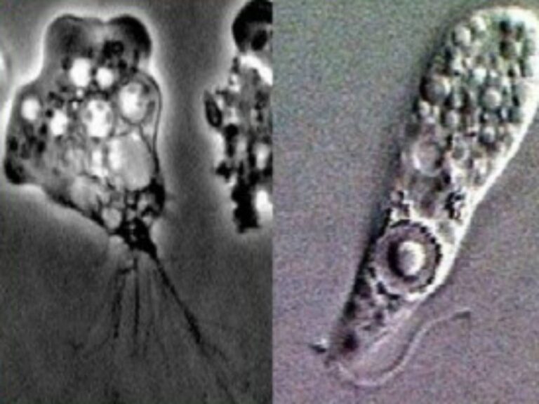 ΗΠΑ: Νεκρή 71χρονη από αμοιβάδα που τρώει τον εγκέφαλο – Το μοιραίο λάθος που έκανε σε κάμπινγκ