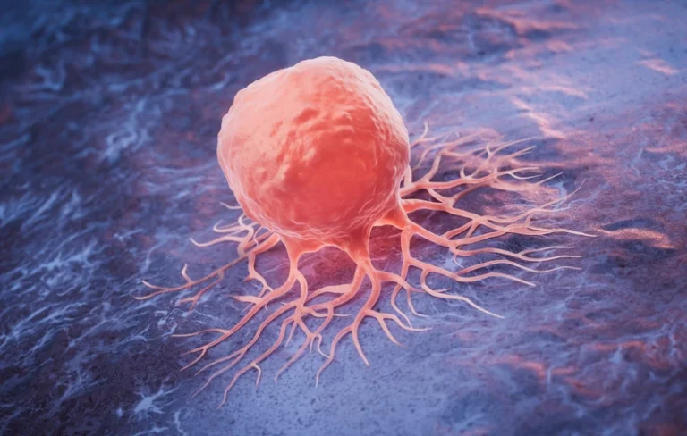 Ανησυχητική αύξηση του καρκίνου του παχέος εντέρου σε νέα άτομα