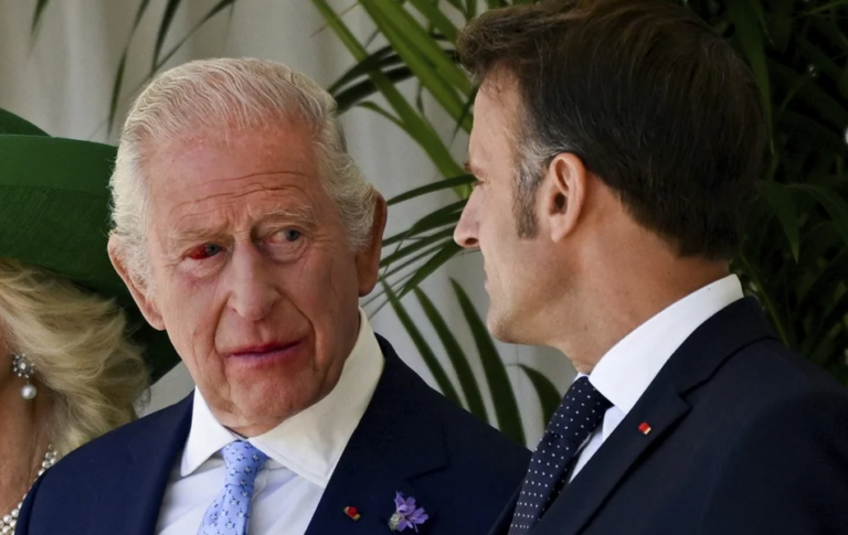 Με κατακόκκινο μάτι-«αίμα» εμφανίστηκε ο βασιλιάς Κάρολος -Η εξήγηση του Παλατιού