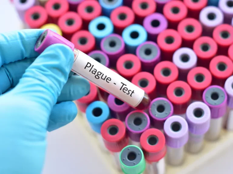 Κάτοικος της Καλιφόρνιας βρέθηκε θετικός στην πανώλη