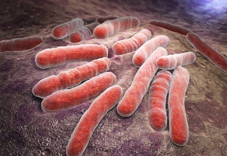 Πανικός σε ΗΠΑ με 10.350 κρούσματα φυματίωσης, επιστρέφει η θανάσιμη απειλή – Ψάχνουν τις εστίες έξαρσης