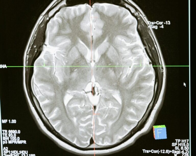 Ινδία / Συναγερμός στις Αρχές λόγω αυξημένων κρουσμάτων «εγκεφαλοφάγας αμοιβάδας»