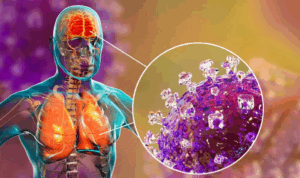 Παγκόσμιος συναγερμός για τον επικίνδυνο ιό Nipah: Τι γνωρίζουμε μέχρι τώρα και πώς μεταδίδεται στους ανθρώπους