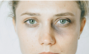 Black Eye symbolic interpretation