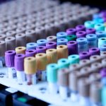 Δείγματα αίματος σε εργαστηριακό περιβάλλον – εικόνα αρχείου. Φωτογραφία Testalize.me / Unsplash