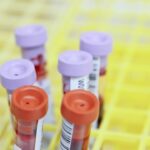 Δείγματα αίματος σε εργαστήριο, θεματική εικόνα